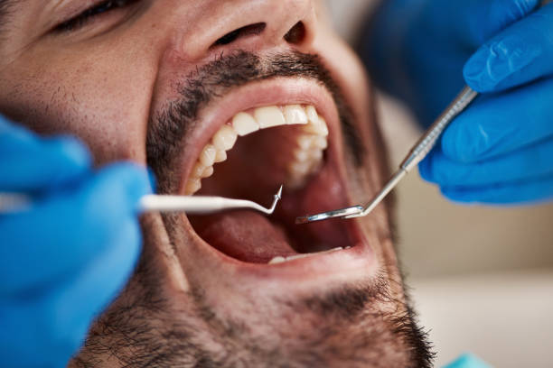 Best Pediatric Emergency Dentist in Gordon Heights, NY